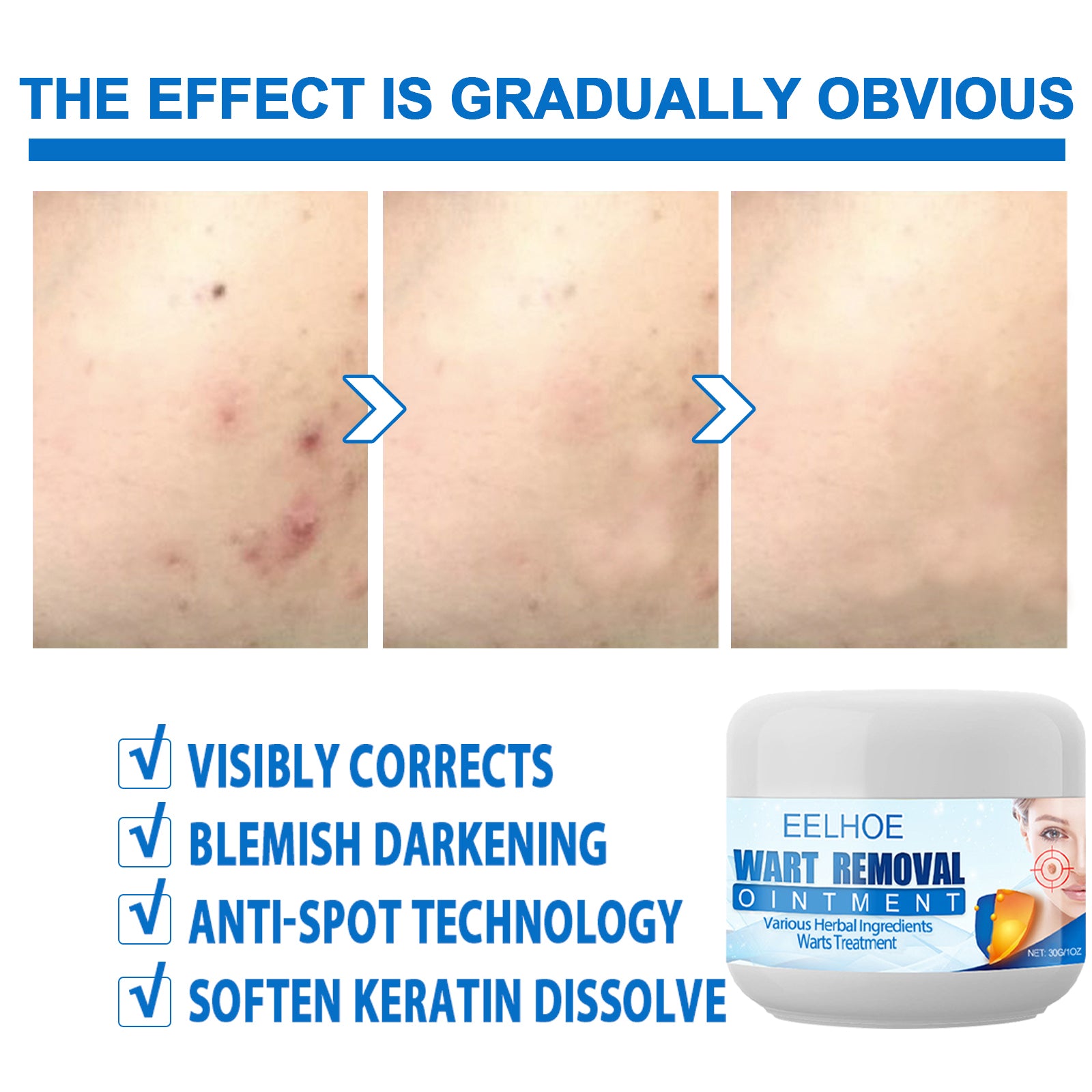 Skin Care Cream, Care For The Body Skin Moisturizing,