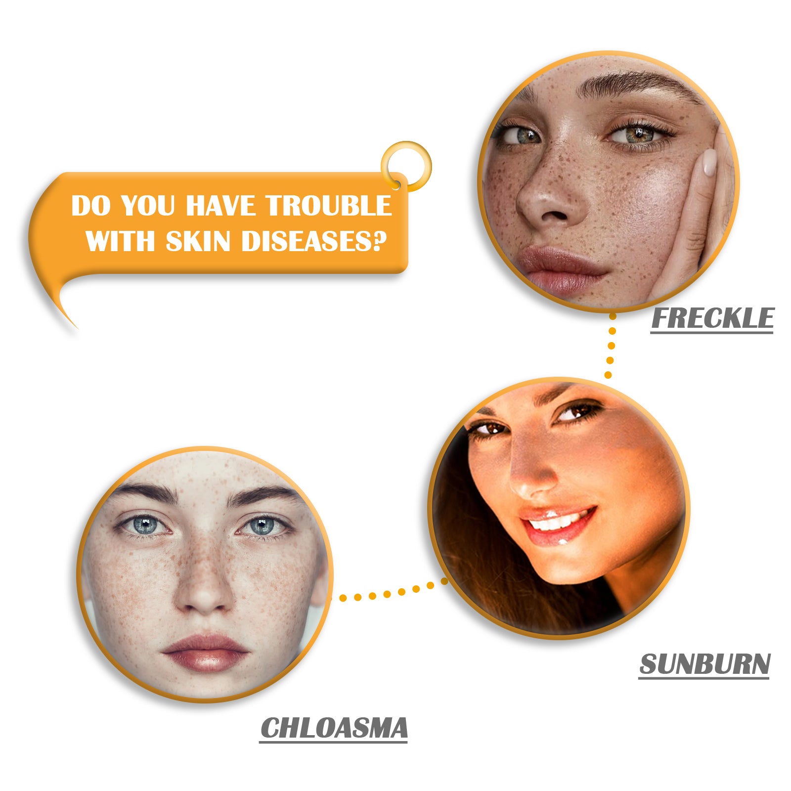 Kojic Acid Soap Cleanser Cleansing Soap