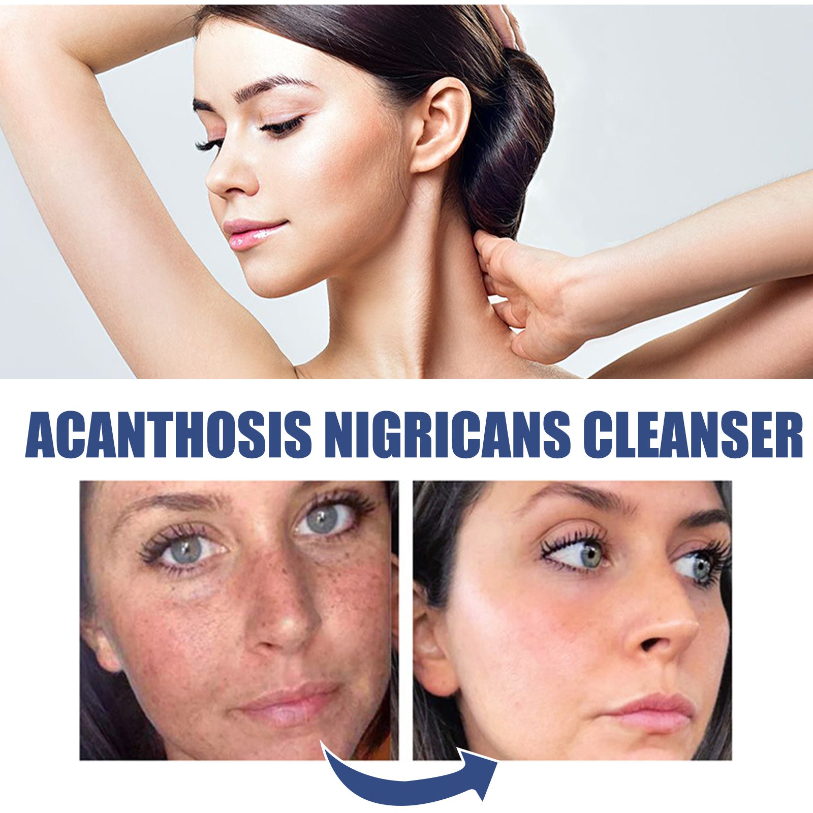 Black Acanthoderm Cleanser Face Deep Clean, Soft And Moisturizing